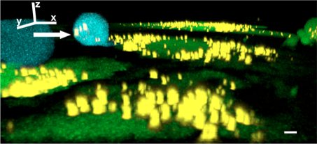 Vesicles emerging from bone cells