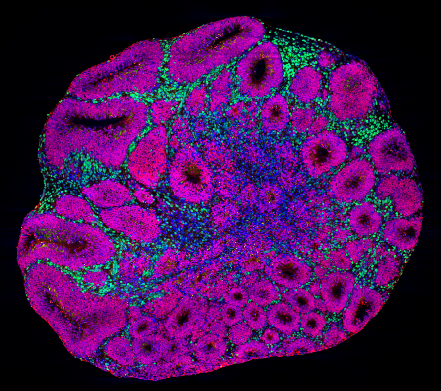 Cells under the microscope, with separate areas of magenta and green.