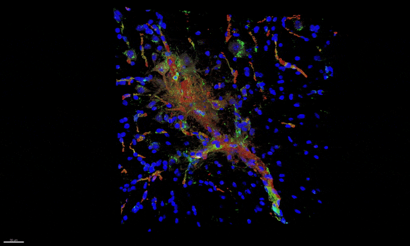 Microscopy of mouse spinal cord.
