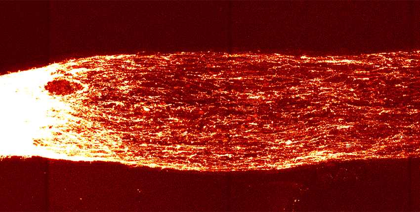 Microscopy image of neuron axons.