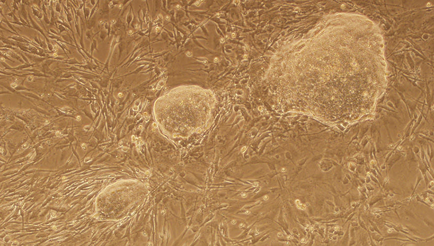 ipsc-colonies-sm-web.jpg