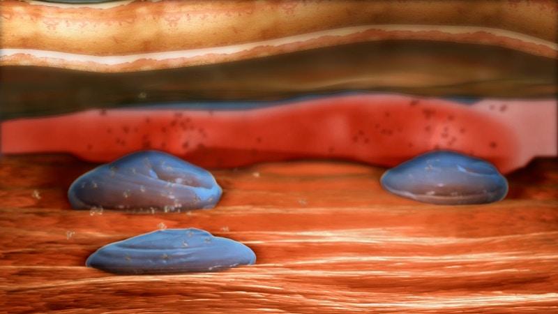 Illustration of small hydrogel circles within tissue.
