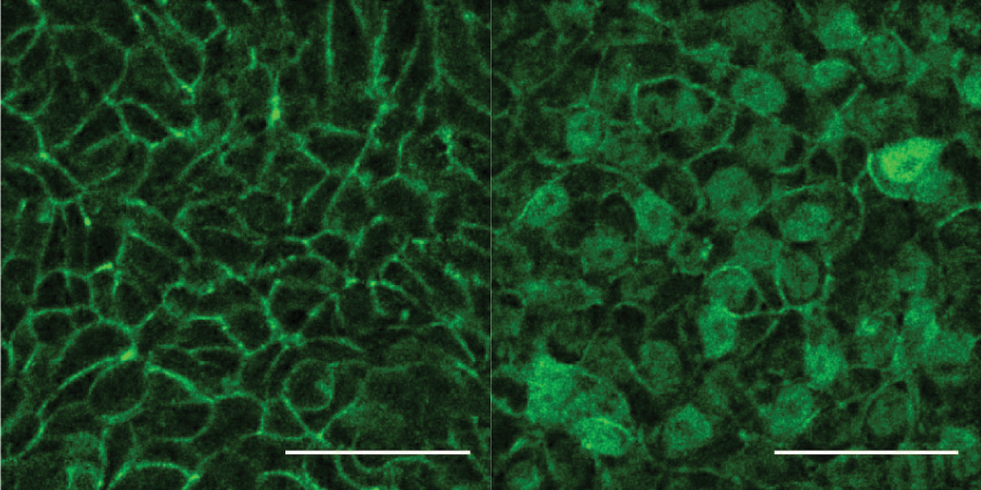 Tail bud cells.