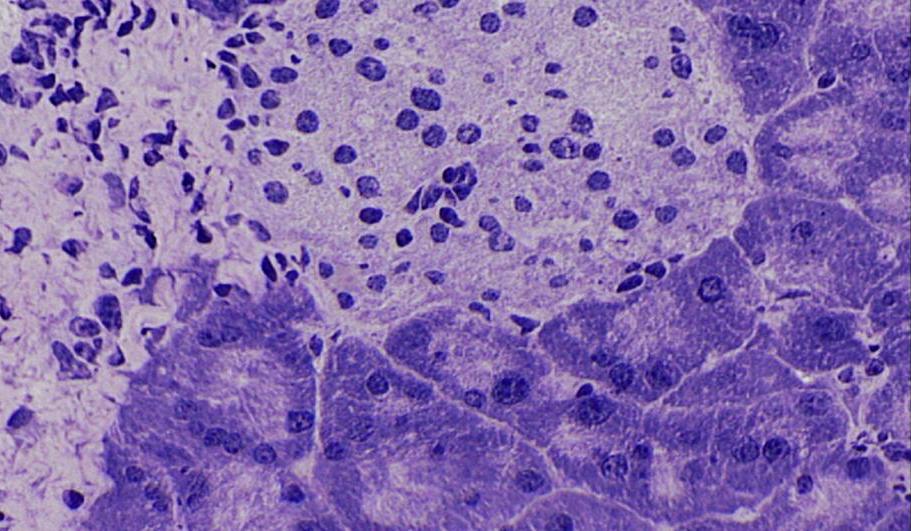 Cells in the pancreas protected from autoimmune attack.