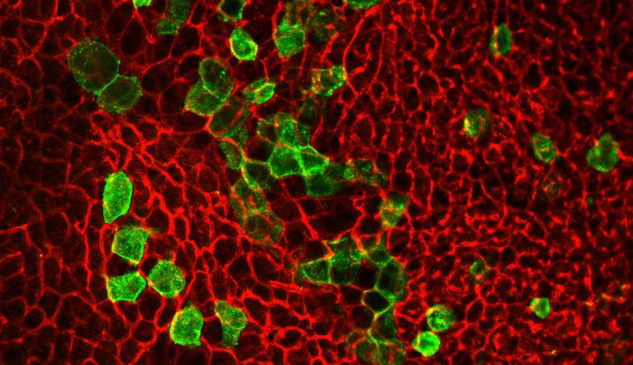 Microscopy image of fat tissue.