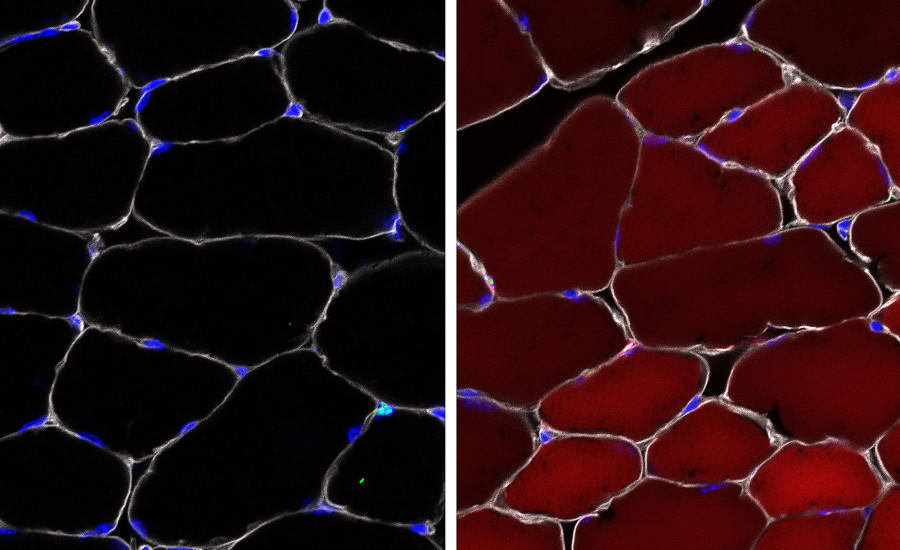 Cells before and after editing.