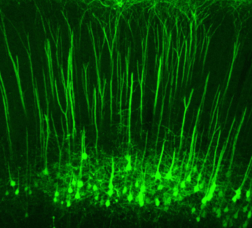 Clifford Woolf and Zhigang He, neuropathic pain, Nature 2018
