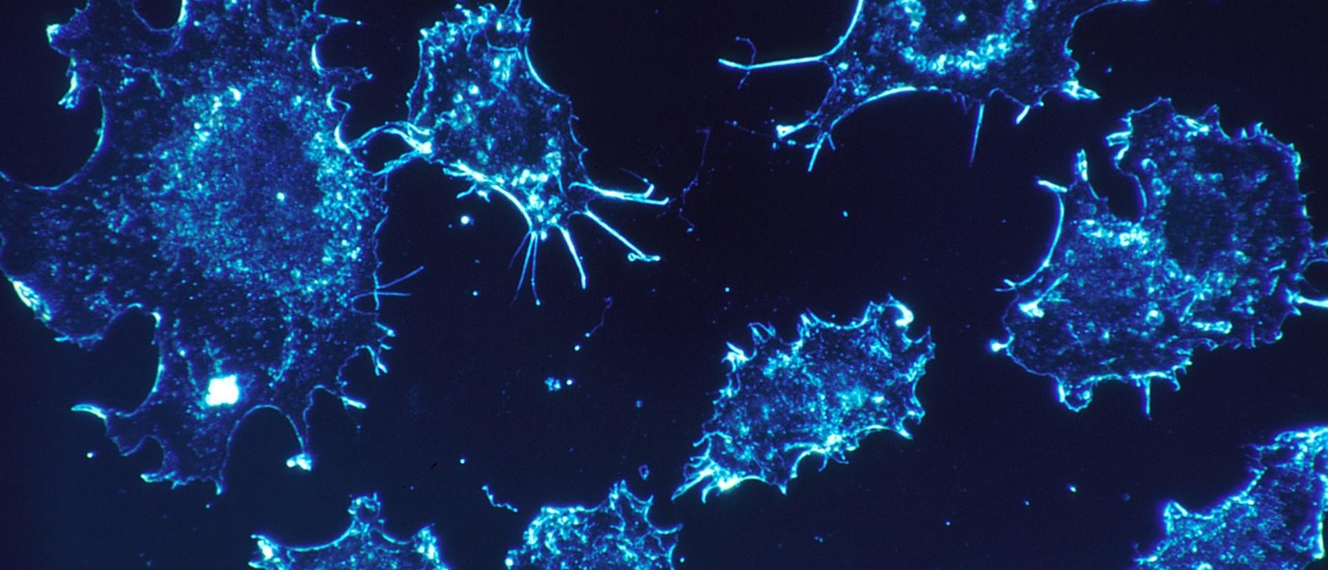 Fluorescent microscopy of blue-stained cancer cells