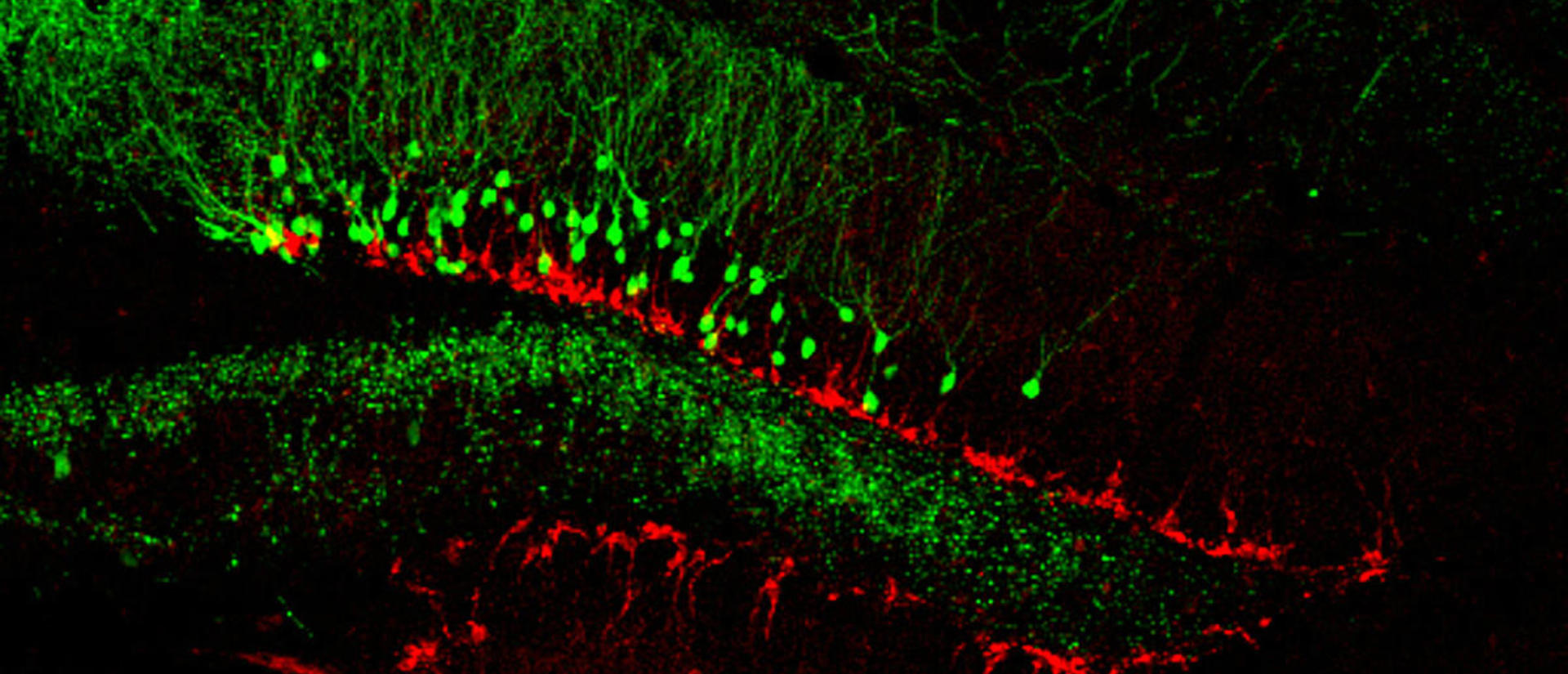 new_and_old_neurons_-_dentate_gyrus_-_kathleen_mcavoy_-_sahay_lab_2.jpg